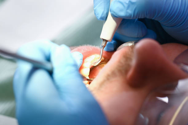 Best Holiday Emergency Dentist in Oswego, IL